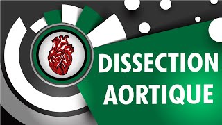 Cardiologie La Dissection Aortique [upl. by Nrev378]