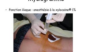 OSTEOPOROSE  tout savoir en 6 minutes [upl. by Nnayllas420]