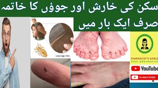 Get rid from Lice attack and Scabies Benzyl Benzoate lotion Treatment for scabies [upl. by Ahseram768]