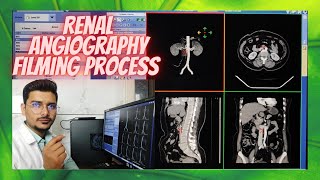 Renal Angiography CT Scan Filming Process amp techniques angiography radiologytechnologist [upl. by Frydman]