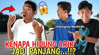 ANEH ARIK Hidungnya Tumbuh Memanjang Sampe BERD4RAH BIKIN SEMUANYA PANIK  Mikael TubeHD [upl. by Allebara]