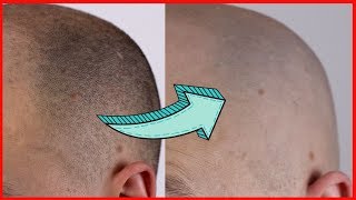 THE BEST HEAD SHAVER Head Shave With Foil Shaver  Remington F9 [upl. by Chrissie]