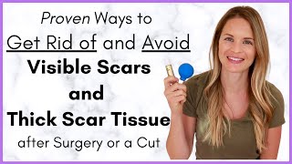 Proven Ways to Heal a Scar Quickly  Avoiding Scar Tissue after Surgery  By a Physical Therapist [upl. by Endor]