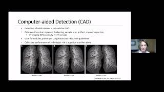 8 in 8 Series Detecting Lung Cancer Earlier Through AIPowered Software [upl. by Congdon]