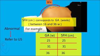 Symphysis Fundal Height  SFH  measurement [upl. by Vickey949]