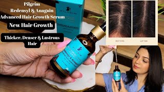 Get Thicker Denser amp Lustrous Hair With PILGRIMS REDENSYL amp ANAGAIN HAIR GROWTH SERUM [upl. by Corsetti]