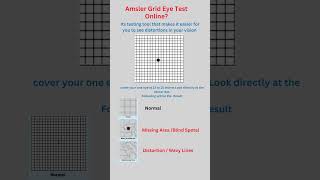 amsler grid testamsler grid chartamsler grid eye testeye grid testvision testblind spot test [upl. by Lyret]