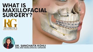 What is Oral and Maxillofacial Surgery Dr Sanchaita Kohli  RG Aesthetics [upl. by Janela]