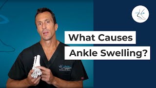 What Causes Ankle Swelling  Ask Dr Moore Houston Foot and Ankle Surgeon [upl. by Enaillil]