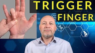 Trigger Finger amp Trigger Thumb  Everything You Need To Know  Dr Nabil Ebraheim [upl. by Nojram]