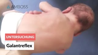 Galantreflex  Frühkindliche Reflexe  AMBOSS Video [upl. by Reuben]