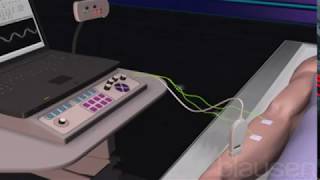 Introduction to Electromyography EMG [upl. by Ekusoyr]