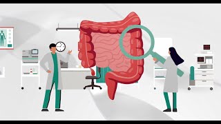 Colorectal Cancer Screening Fecal Immunochemical Test FIT  OCSENSOR [upl. by Adlev]