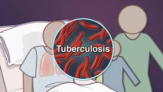 Contact Investigation for Tuberculosis [upl. by Ileane207]