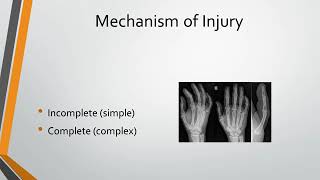 MCP Joint Dislocation [upl. by Chainey828]