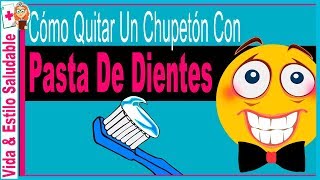 Cómo quitar un chupetón con Pasta De Dientes ✫ TRUCO que NO CONOCES FUNCIONA ❤ [upl. by Pasco641]