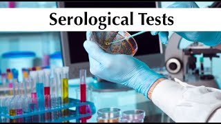 Microbiology 5th practical tuotorial quotSerological Testsquot by ASM Minds Team [upl. by Acimak]