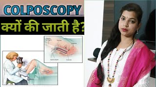 Colposcopyकॉल्पोस्कोपी क्या है  Colposcopy Test in Hindi [upl. by Oralle953]