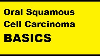 Oral squamous cell carcinoma  Basics [upl. by Cinnamon818]