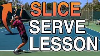 Improve Your Slice Serve Right Away With These 5 Tips [upl. by Anaihr]