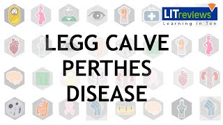 Legg Calve Perthes Disease [upl. by Kotz909]