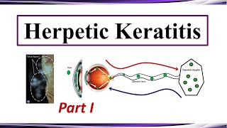 Herpetic Keratitis  Pathogenesis and Clinical Presentation Part I [upl. by Lowrance94]