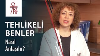 Tehlikeli benler nasıl anlaşılır Kanser riski taşıyan benlerin tedavisi nasıl yapılır [upl. by Essiralc]