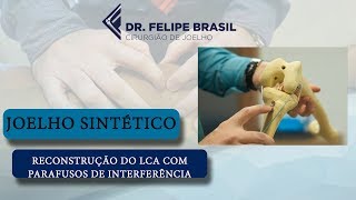 CIRURGIA DO LCA COM PARAFUSOS DE INTERFERÊNCIA  WORKSHOP [upl. by Llib563]