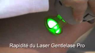 epilation laser au gentlelase proavi [upl. by Nahallac260]