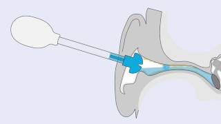 earClin earshower  how to use [upl. by Fidel]