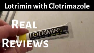 Lotrimin Antifungal Cream [upl. by Lacey354]