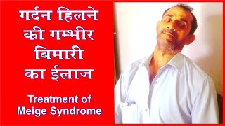 Neck Treatment II Acupressure Treatment II गर्दन हिलने की गम्भीर समस्या का उपचार [upl. by Ademordna]