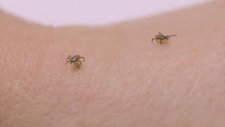 Ticks amp Lyme Disease What to know in 2024 [upl. by Kaylil]