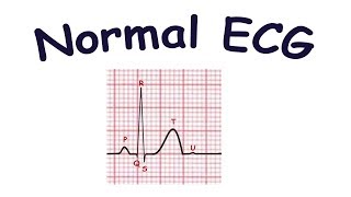 Normal ECG [upl. by Mistrot255]