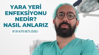 Yara Yeri Enfeksiyonu Nedir NASIL ANLARIZ [upl. by Ahsan]