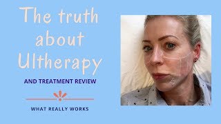 The truth about Ultherapy  Alice HartDavis [upl. by Zanahs491]