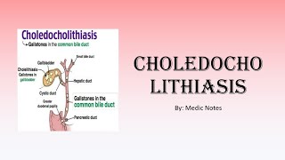 Choledocholithiasis  definition signs and symptoms investigation treatment [upl. by Fortunna]