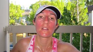 DermTV  Why Exercise Makes Your Face Red DermTVcom Epi 286 [upl. by Ebneter]