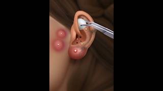 Asmr ear cleaning [upl. by Belen]