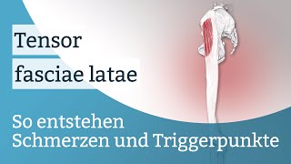 Tensor fasciae latae Schmerzen Triggerpunkte und deren Aktivierung [upl. by Sarita]