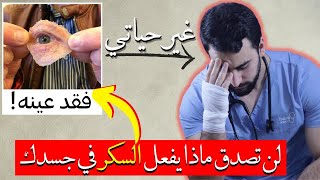 هذا ما سيحصل في جسمك اذا امتنعت عن تناول السكر ،ما هي البدائل؟ [upl. by Sokairyk]