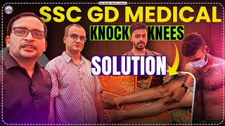 SSC GD Medical 2024 Knock Knees Solution Rojgar With Ankit rojgarwithankit rwa [upl. by Graniela]