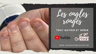 Les ongles rongés tout savoir et gérer 😃💪 [upl. by Gae]