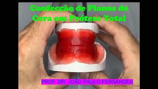 9  Plano de cera para Prótese Total [upl. by Kaltman718]