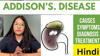 Addison’s Disease  Explained in Hindi  Causes Signs amp Symptoms Diagnosis amp Treatment  Notes [upl. by Aliak]