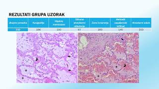 Doktorat  Jelena Kuzmanović  Uloga interleukina 6 8 i 18 u patogenezi akutnog respiratornog [upl. by Eerbua]