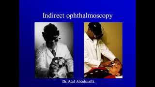 Optics course new Indirect Ophthalmoscopy [upl. by Beckerman117]