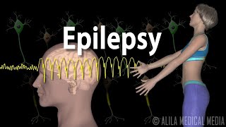 Epilepsy Types of seizures Symptoms Pathophysiology Causes and Treatments Animation [upl. by Nnairrek70]