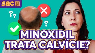 Minoxidil funciona mesmo [upl. by Berkeley]