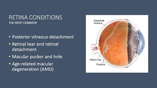 Demystifying Retinal Diseases [upl. by Atenaz]